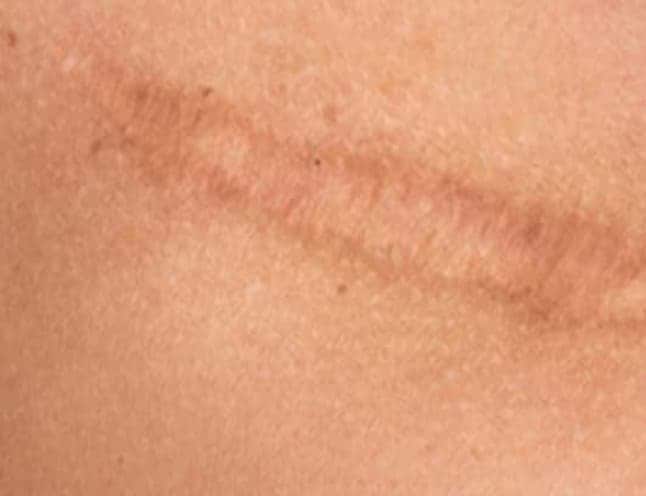 ünlü c bölümü yara izi